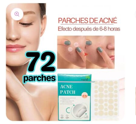 Acne Pimple Patch For Face Skin 72 Hypoallergenic Waterproof Patches Invisible Facial Stickers Cover With 100% Hydrocolloid Absorbs Pimple Overnight Reduces Excess Oil For All skin Type SR_7854